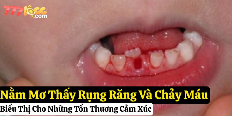 nằm mơ thấy rụng răng